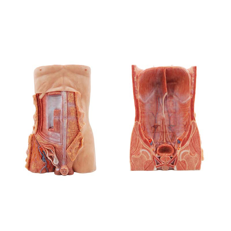 Inguinal Hernia Model Inguinal Hernia Model